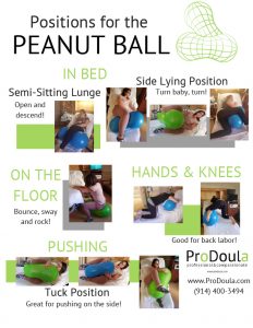 The Peanut Ball: A New Snack or a Tool Used for Birth?